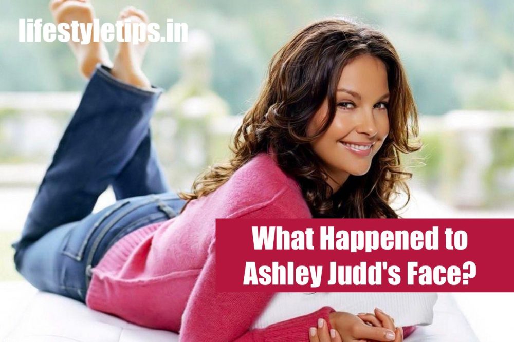 What happened to Ashley Judd's face